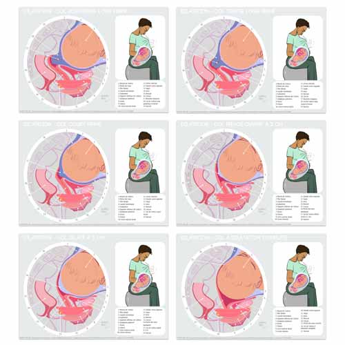 Fiches numériques de la dilatation du col déclinées avec légendes complètes à chaque étape