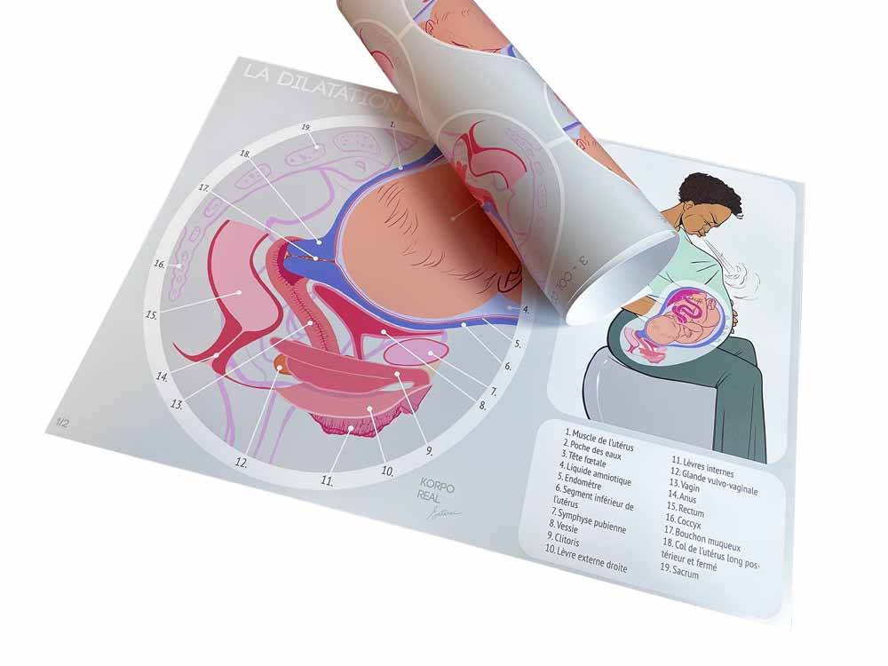 Posters de dilatation du col, lot de 2 planches A2