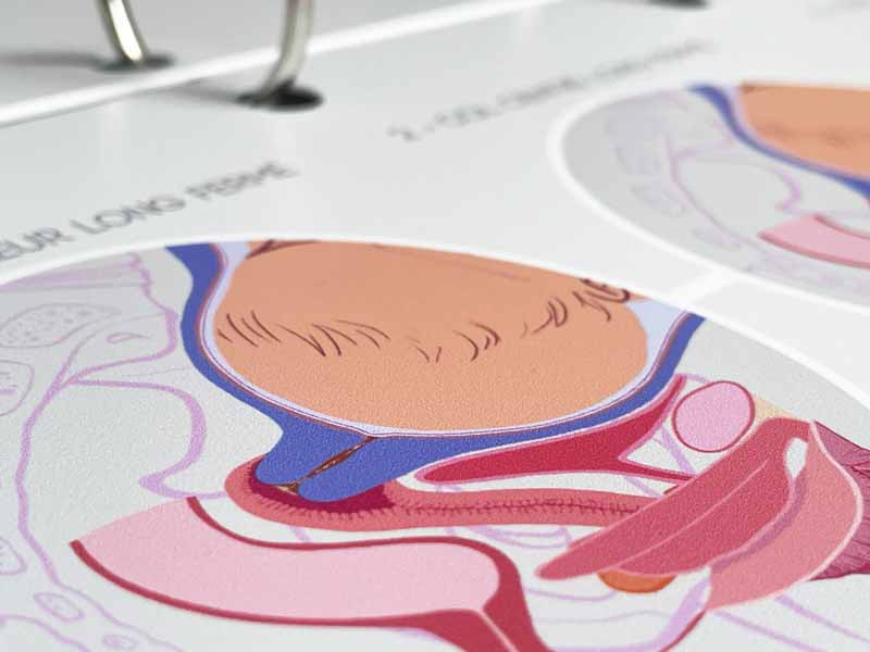 Zoom sur la deuxième fiche A4 illustrant les premiers centimètres de dilatation du col – visuel précis et contrasté