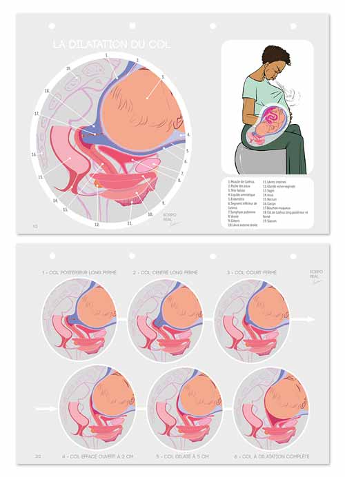 Fiches pédagogiques sur la dilatation du col, lot de 2 A4 perforées
